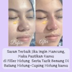 fillerbenang_hidung_testi.JPG