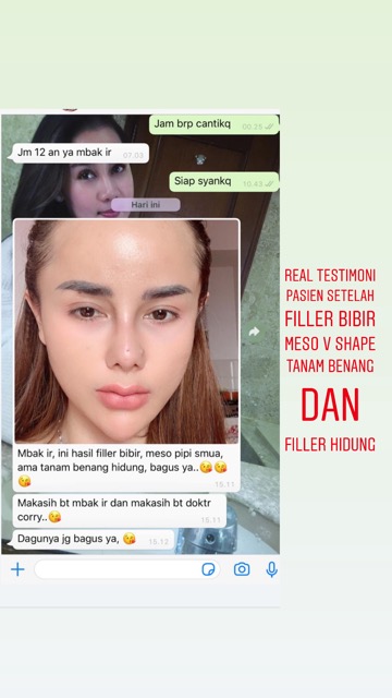 Korean V-Shaped Procedure Riyena Orthomedik